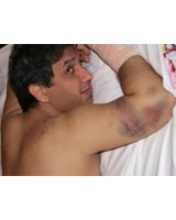 عکسی از علی کروبی پس از بازداشت