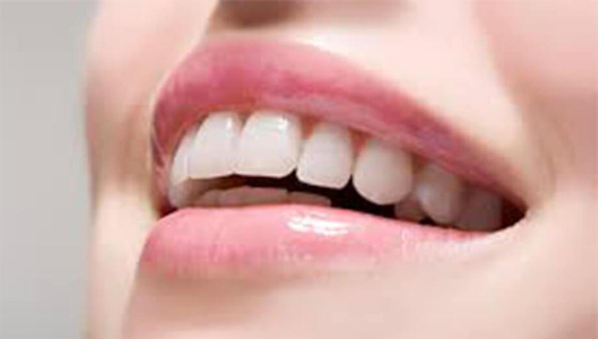 روش‌های سفید کردن دندان چیست؟
